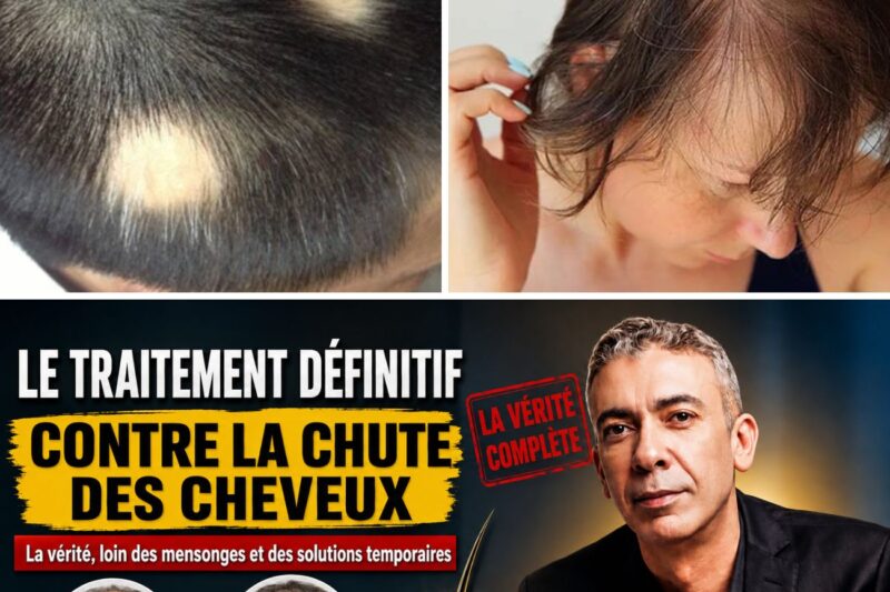 Chute de cheveux : le détail que beaucoup négligent avant de dépenser une fortune en traitements