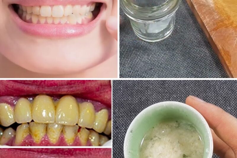 Dents jaunes : l’astuce maison de 2 minutes qui intrigue tout le monde — mais attention à ne pas faire n’importe quoi